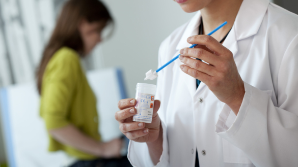 Lång väntan på svar från cellprovtagning